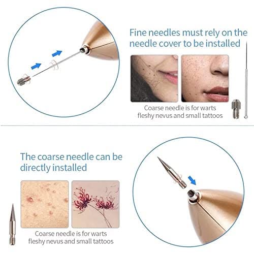Beauty Mole Removal Sweep Spot Pen – Precision Skin Spot Care Device for Home Use